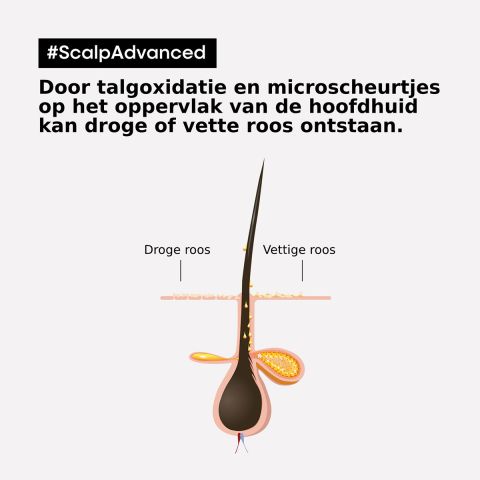 L'Oréal Professionnel - Scalp Advanced - Anti-Dandruff - Anti-dandruff Shampoo